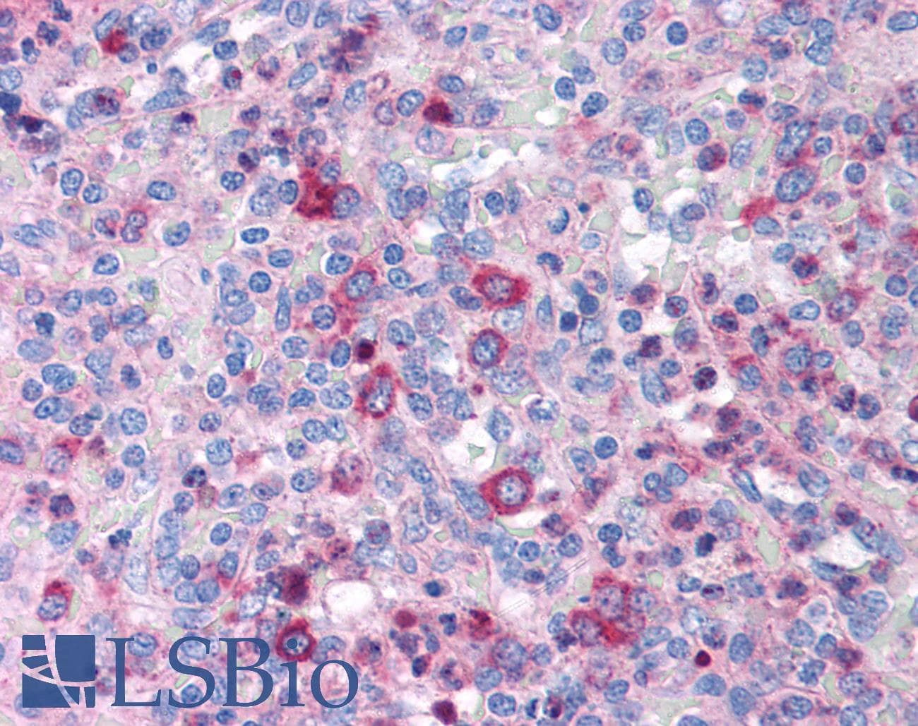 Polyclonal Rabbit anti-Human GATA3 Antibody (aa364-413, IHC, WB)