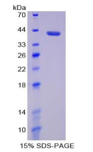 Rat MMP23 Protein (Recombinant His-T7)