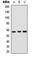 CDKN1C / p57 Kip2 Antibody (N-Terminus)
