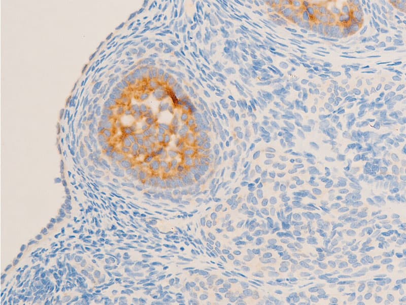 NR3C1/Glucocorticoid Receptor Antibody (phospho-Ser211)