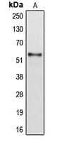 CYP2B6 Antibody (Internal)