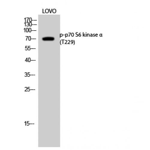 RPS6KB1 / P70S6K / S6K Antibody (170-250 aa)