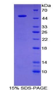 Human CST / GAL3ST1 Protein (Recombinant His-GST)