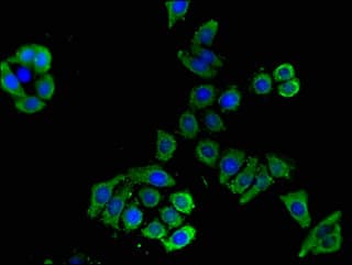 SLC16A9 Antibody