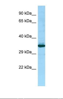Polyclonal Rabbit anti-Human PEX14 Antibody (C-Terminus, WB)