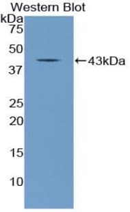 NPPC Antibody (aa31-126)