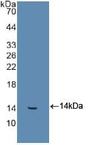 FGB / Fibrinogen Beta Chain Antibody (aa29-118)
