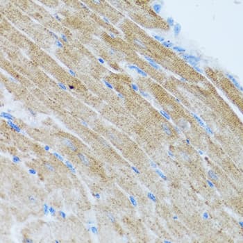 CCL2 / MCP1 Antibody