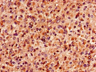 Polyclonal Rabbit anti-Human MAP4 Antibody (IHC, IF)