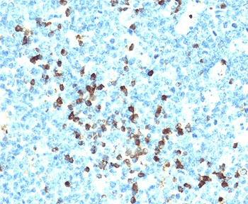 Lambda Light Chain Antibody (clone LcN-2 + ICO-106)