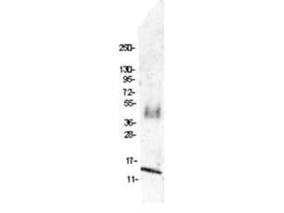 CCL4 / MIP-1 Beta Antibody
