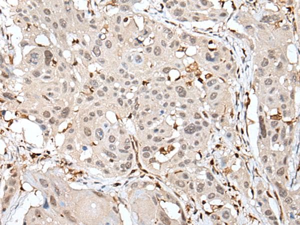 ARHGDIB / D4 GDI Antibody