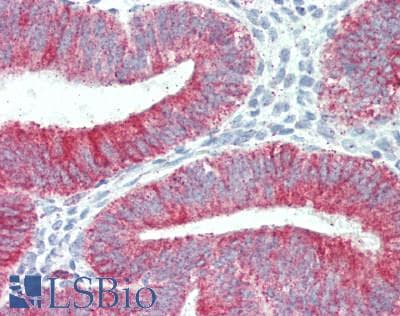 IHC-plus™ SIPA1L3 Antibody (aa1731-1781)
