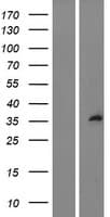 SPRY1 / Sprouty 1 Protein (Over-Expression Lysate Myc-DDK (Flag))