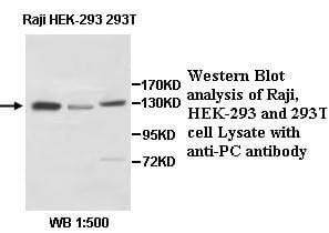 Polyclonal Rabbit anti-Human PC / Pyruvate Carboxylase Antibody (aa74-371, IHC, WB)