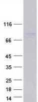 Human DDX17 Protein (Recombinant Myc-DDK (Flag))
