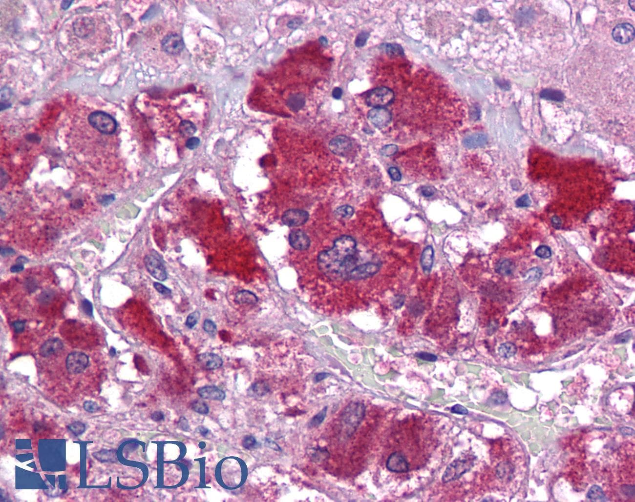 IHC-plus™ KIAA0652 / ATG13 Antibody
