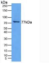 TGM3 / Transglutaminase 3 Antibody (aa468-693)