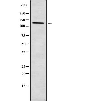 PDE3B Antibody