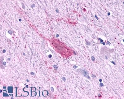 PathPlus™ Polyclonal Rabbit anti-Human MTNR1A / Melatonin Receptor 1a Antibody (Cytoplasmic Domain, IHC)