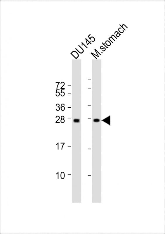 Monoclonal Mouse anti-Human RAB27B Antibody (clone 1596CT245.254.49, WB)