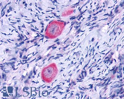 PathPlus™ Polyclonal Rabbit anti-Human ACKR3 / CXCR7 Antibody (Cytoplasmic Domain, IHC, WB)