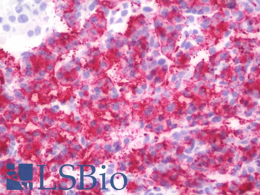 IHC-plus™ RICK / RIP2 Antibody (clone 7F5)