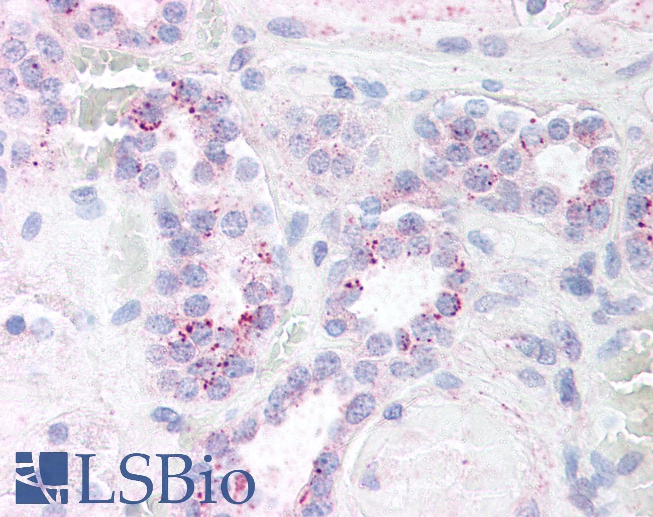 IHC-plus™ Polyclonal Rabbit anti-Human RELA / NFKB p65 Antibody (phospho-Ser536, IHC, WB)