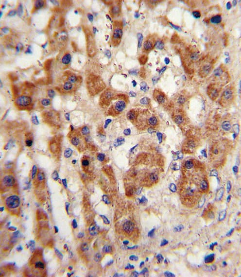 NAT2 Antibody (aa226-254)