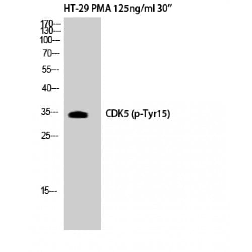 CDK5 Antibody (1-80 aa)