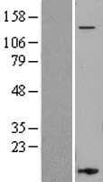 ITGAL / CD11a Protein (Over-Expression Lysate Myc-DDK (Flag))