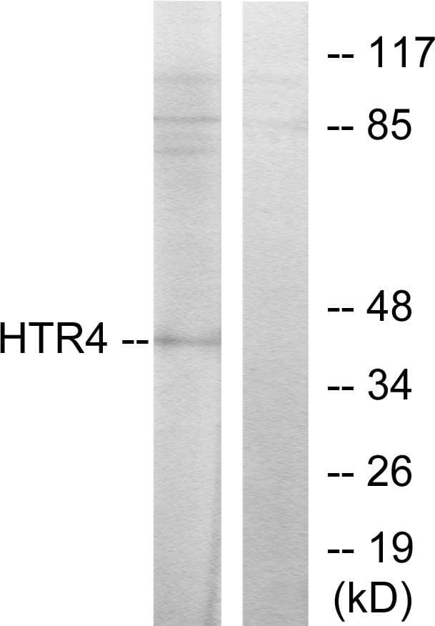 Polyclonal Rabbit anti-Human HTR4 / 5-HT4 Receptor Antibody (IF, WB)