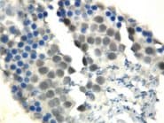 RAD51 / RECA Antibody (N-Terminus, Sepharose)