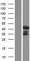 Human ADA / Adenosine Deaminase Protein (Over-Expression Lysate Myc-DDK (Flag))