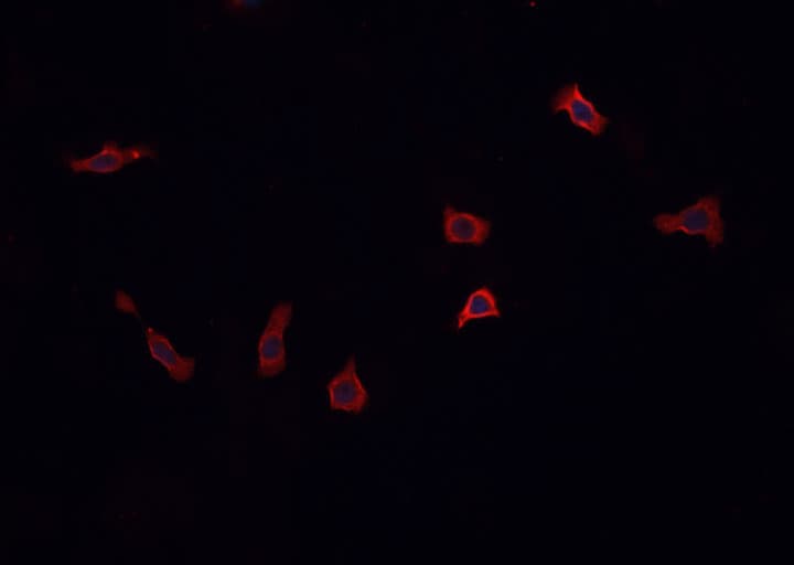Polyclonal Rabbit anti-Human STX1A / Syntaxin 1A Antibody (IHC, IF, WB)