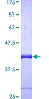 Human GLRX / Glutaredoxin Protein (Recombinant GST)