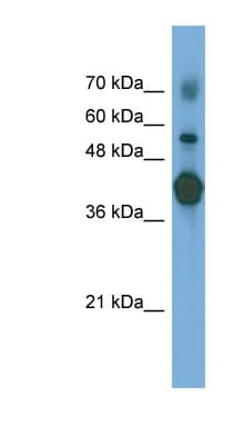 Polyclonal Rabbit anti-Human PTX3 / Pentraxin 3 Antibody (N-Terminus, WB)