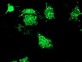 SIRT5 / Sirtuin 5 Antibody (clone OTI1A6, Carrier-free)