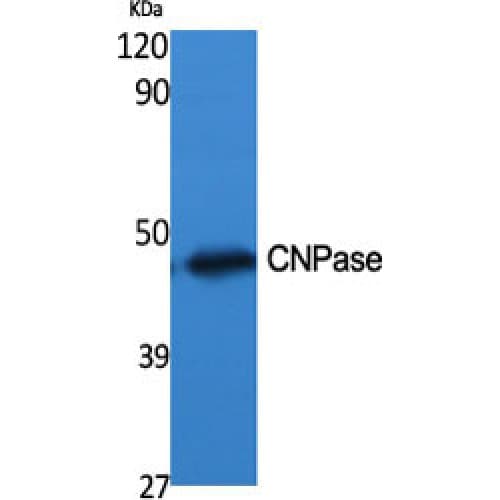 Polyclonal Rabbit anti-Human CNPase Antibody (Internal, IHC, WB)