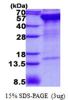 Human RPN2 / Ribophorin II Protein (Recombinant His)
