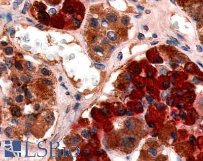 IHC-plus™ GHRHR Antibody (Cytoplasmic Domain)