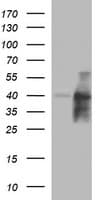 UPRT Antibody (clone OTI2F2)