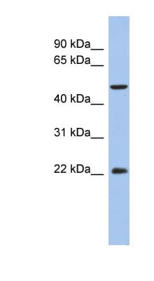 Polyclonal Rabbit anti-Human ANKH Antibody (aa107-156, WB)