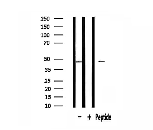ABHD8 Antibody