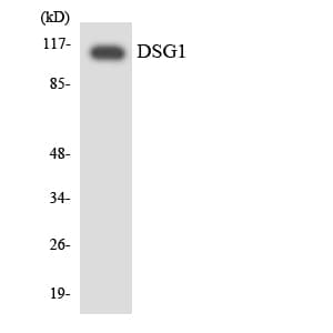 Polyclonal Rabbit anti-Human DSG1 / Desmoglein 1 Antibody (aa145-194, WB)