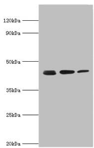 ACTR2 / ARP2 Antibody (aa1-160)