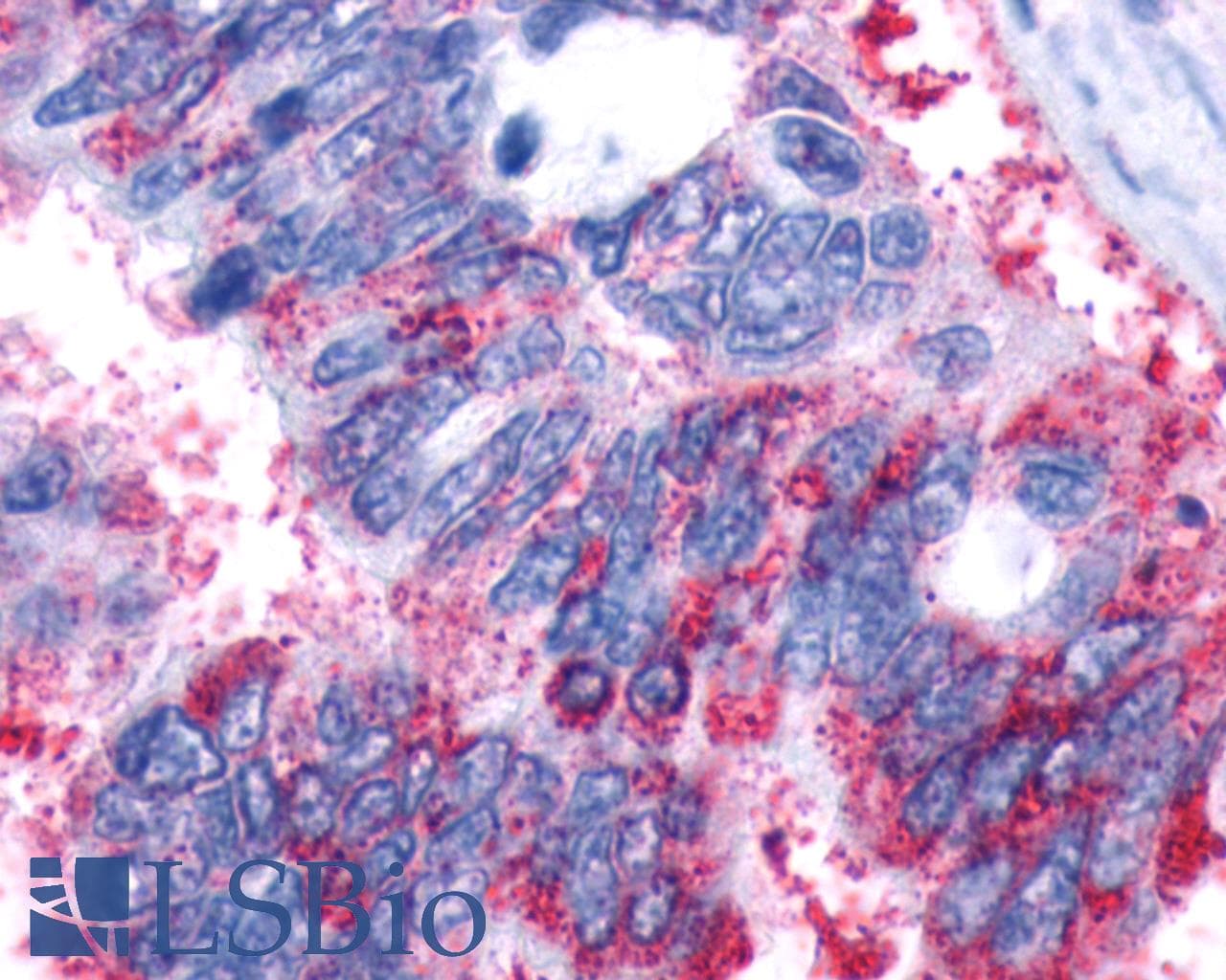 PathPlus™ GPR161 Antibody (N-Terminus)