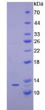 Human CXCL10 / IP-10 Protein (Recombinant His-T7)