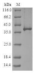 Human RGS20 / RGSZ1 Protein (Recombinant GST, N-terminus)