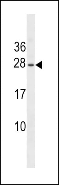 Polyclonal Rabbit anti-Human EPO / Erythropoietin Antibody (WB)